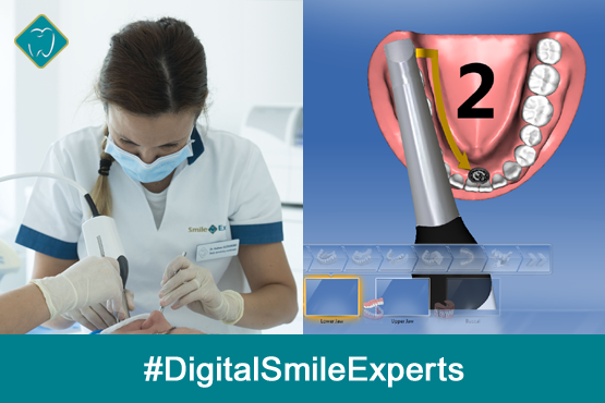 Aparat dentar Invisalign  Clinica Stomatologica Smile Experts